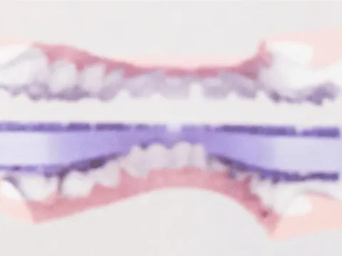 Bàn chải răng thông minh của bác sĩ Việt được Mỹ cấp bằng sáng chế