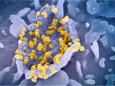 Biến thể Lambda lan sang châu Á, có khả năng kháng vaccine
