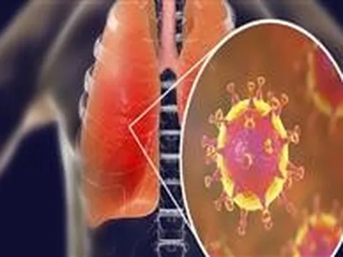 Các bài nghiên cứu mới về COVID-19 từ ngày 17/9 đến ngày 24/9/2021