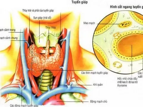 Giá trị của các phương pháp chẩn đoán và xây dựng quy trình chẩn đoán u tuyến giáp