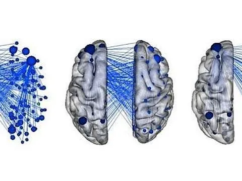 Máy học tiết lộ mạng lưới não liên quan đến sự hung hăng của trẻ em