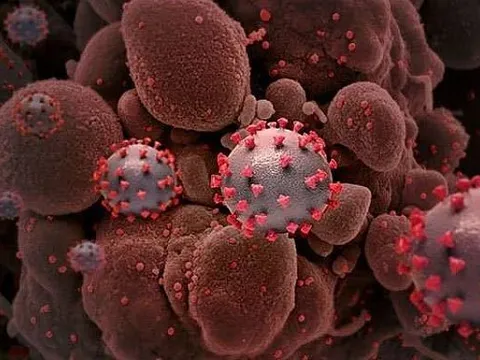 Dấu hiệu di truyền có thể dự đoán mức độ nghiêm trọng khi nhiễm COVID-19