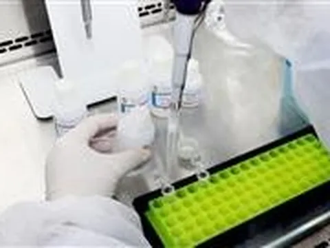 Sáng chế tại trường đại học có tiềm năng ứng dụng cao