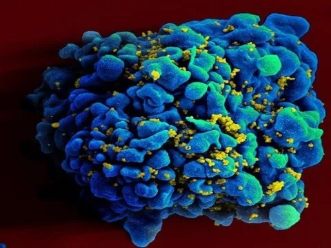 Vaccine mARN ngăn HIV cho kết quả tốt ở động vật