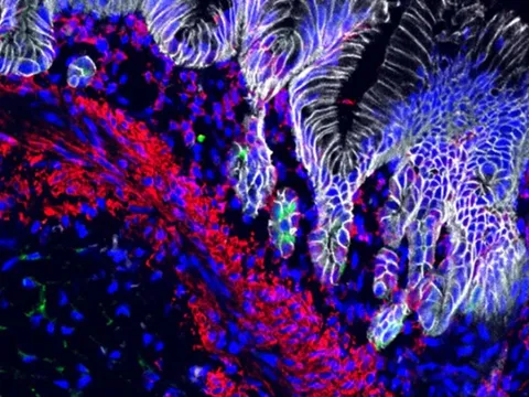 Dạ dày mini có thể tiết axit trong phòng thí nghiệm