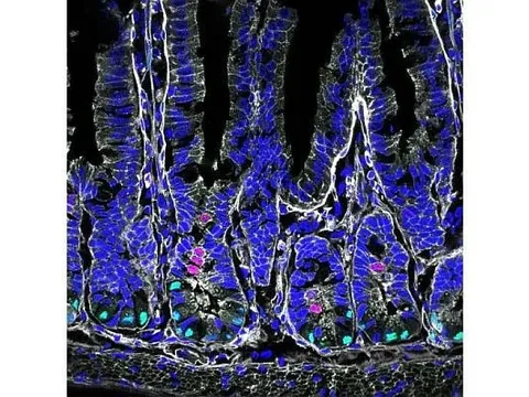 Mối liên hệ mới giữa chế độ ăn uống, tế bào gốc đường ruột và bệnh tật