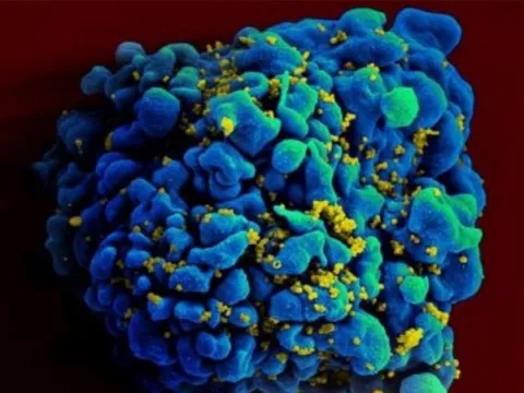 Thử nghiệm thành công vaccine HIV trên động vật