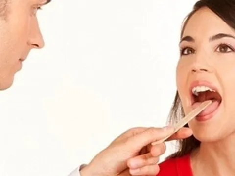 Chuyên gia Việt Nam nghiên cứu thành công phương pháp tạo hình khuyết hổng lưỡi sau phẫu thuật ung thư