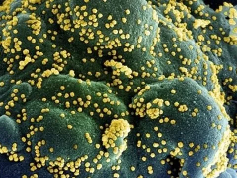 Phát hiện biến thể mới của virus SARS-CoV-2 chứa 46 đột biến